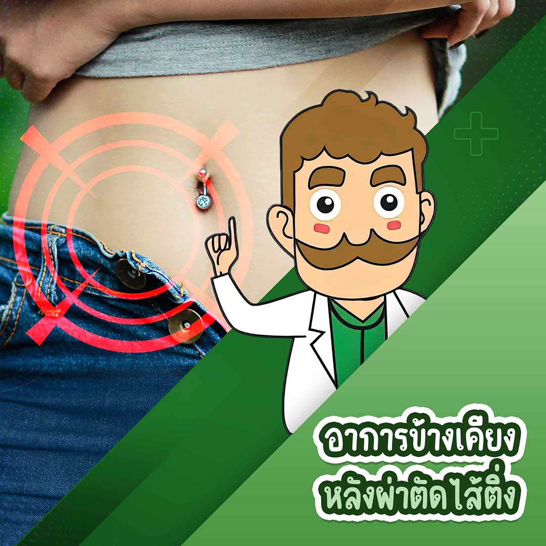 อาการข้างเคียงหลังผ่าตัดไส้ติ่ง และวิธีการดูแล